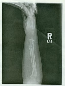 x_ray